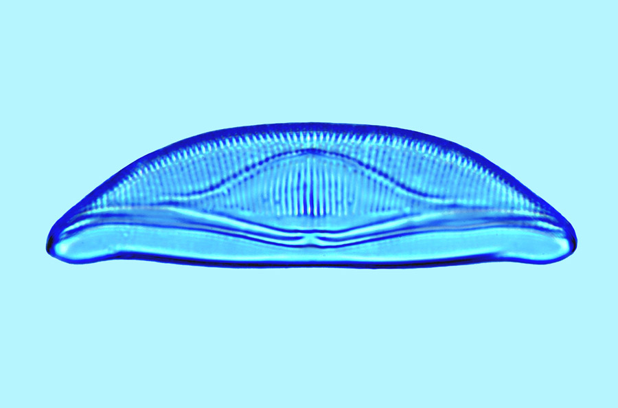 Amphora Amphora bioculata